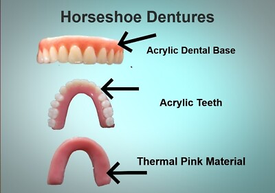 #ad #ad DIY Denture Horseshoe Temporary Dentures DIY Denture SMALL $55.00