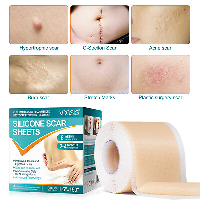 #ad Scar Removal Silicone Tape for Hypertrophic Scars amp; Keloids 1.6#x27;#x27; x 60#x27;#x27; 150quot; $27.95